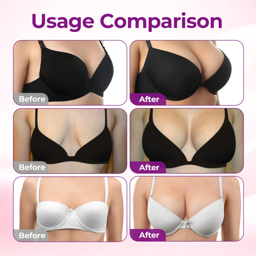 Anyumm™ Targeted Breast Enhancement Advanced Nano Microneedle Patch
