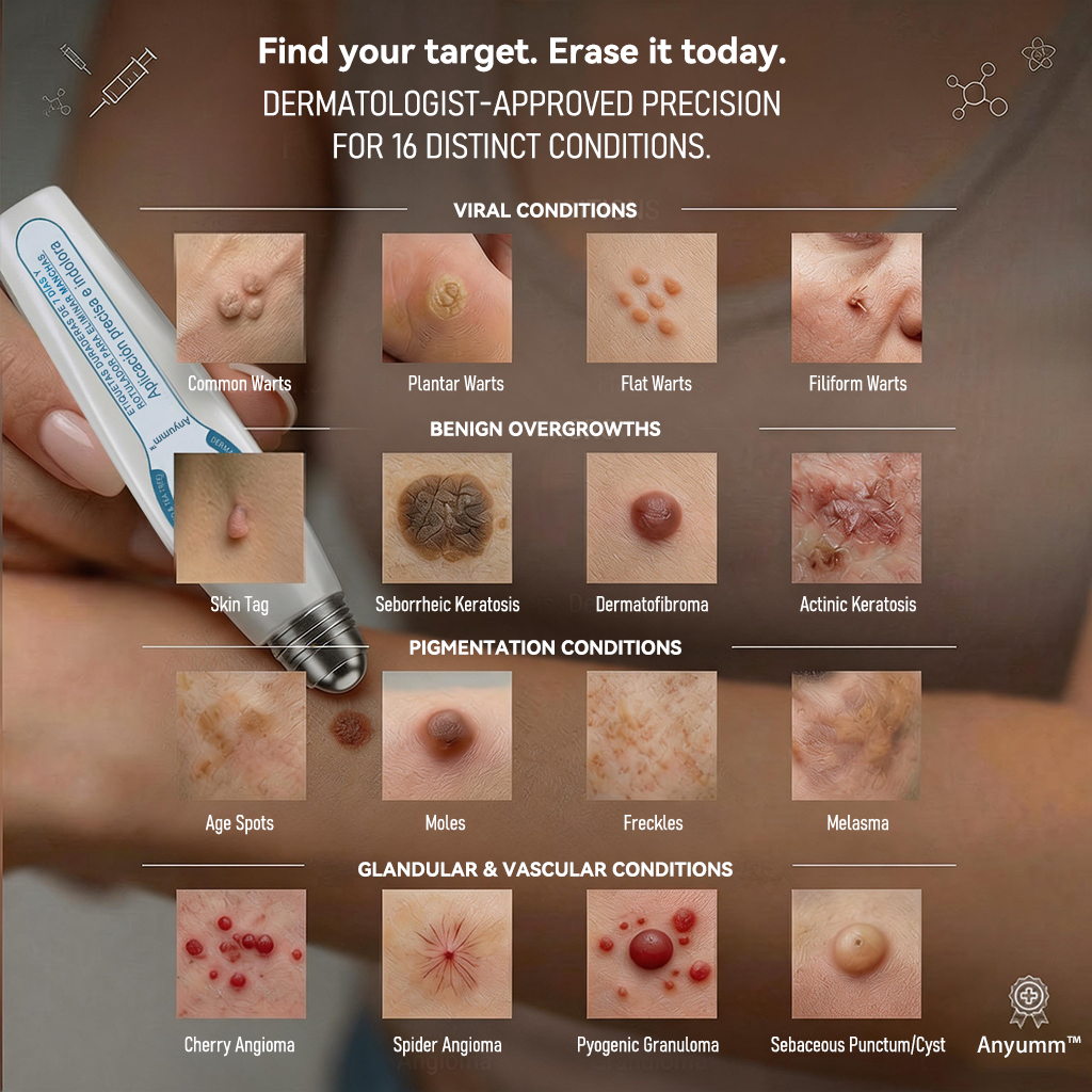Official Brand Store |✅🧑🏻‍⚕️Anyumm™ 7-Day Tag & Spot Eraser(Zero Pain, Zero Scars Rollerball)