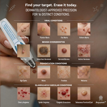 Official Brand Store |✅🧑🏻‍⚕️Anyumm™ 7-Day Tag & Spot Eraser(Zero Pain, Zero Scars Rollerball)