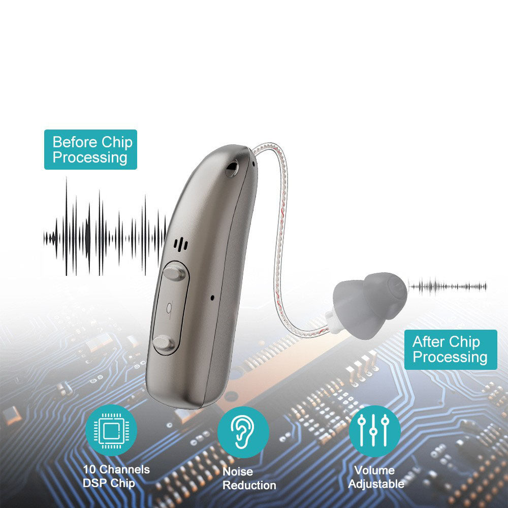 🔥Anyumm™ Smart Sound Support - Hear Clearly Again | 60% OFF