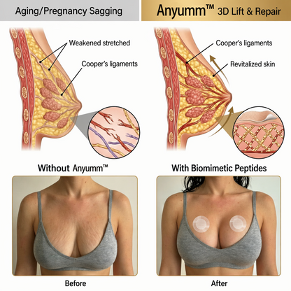 Anyumm™ Targeted Breast Enhancement Advanced Nano Microneedle Patch